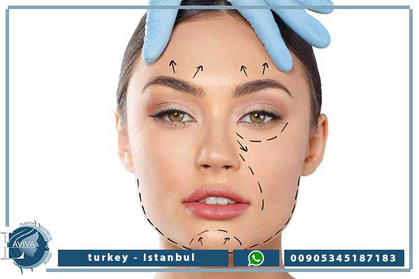 شد الوجه في تركيا