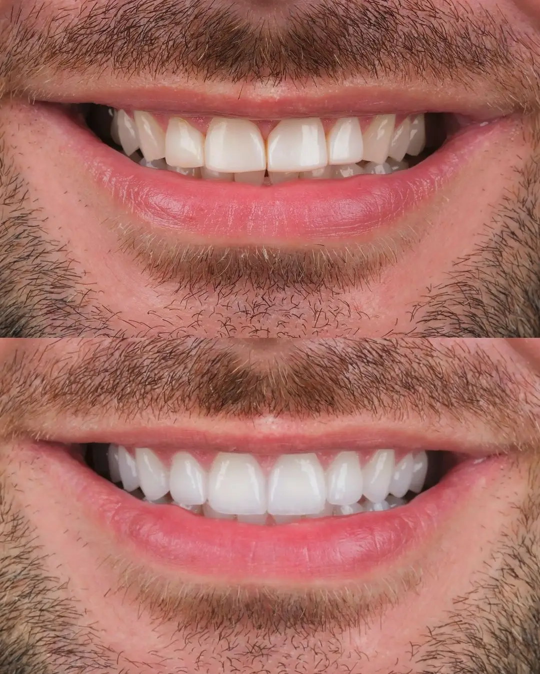 Before and after result, patient photo 5