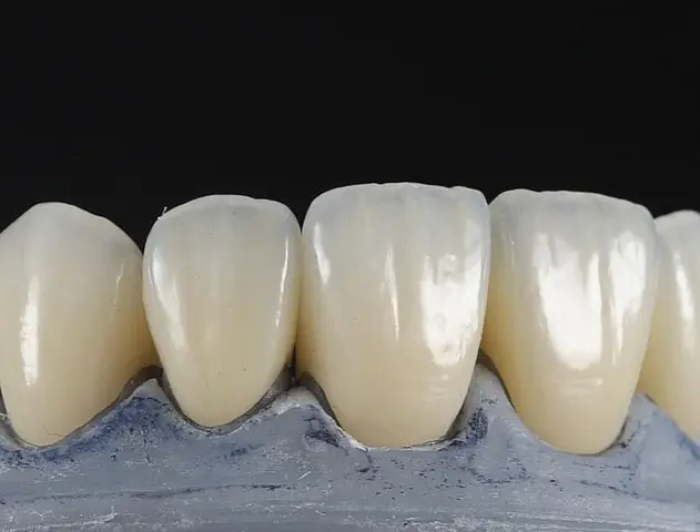 التقنيات المستخدمة في مخبر الأسنان