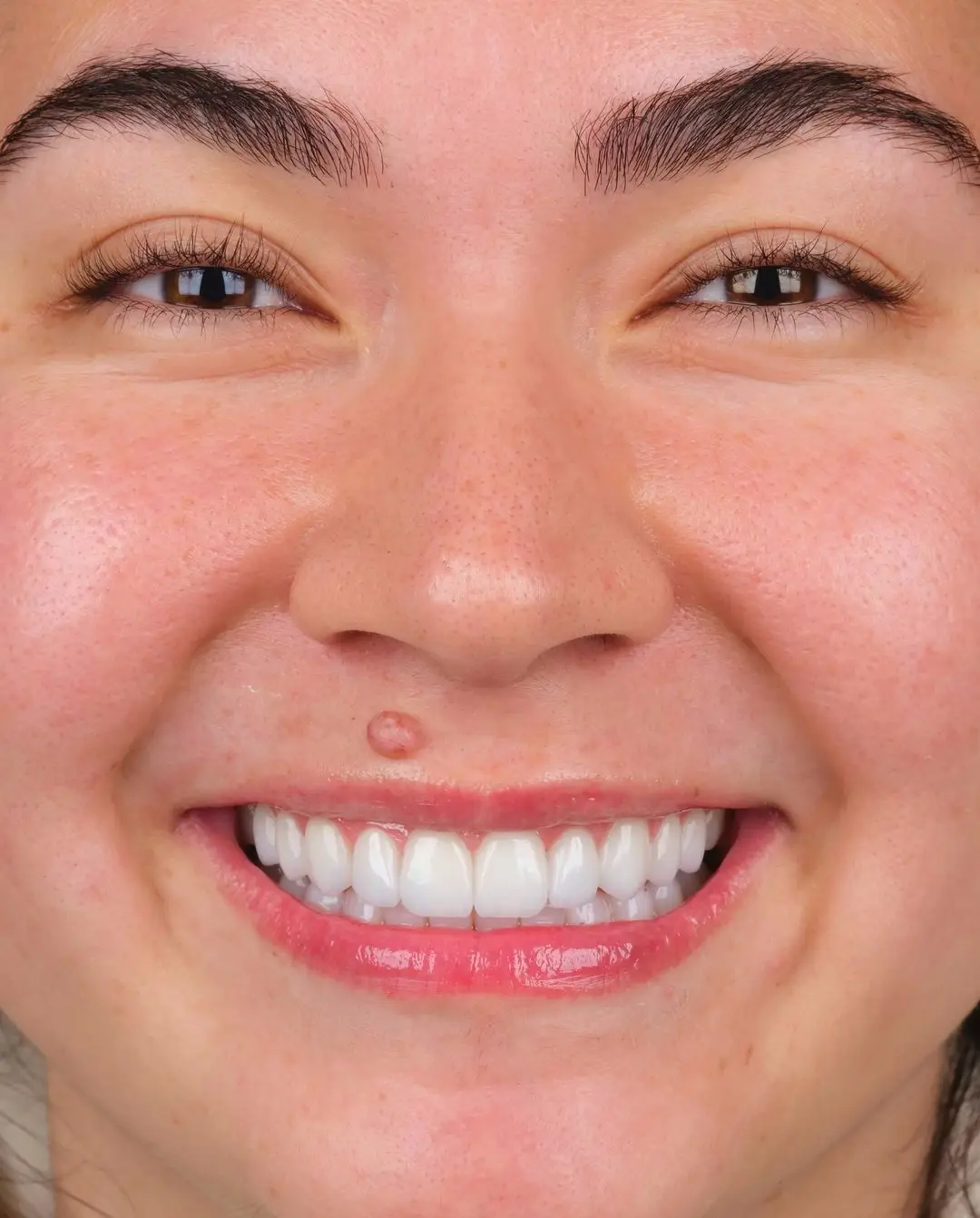 Before and after result, patient photo 1