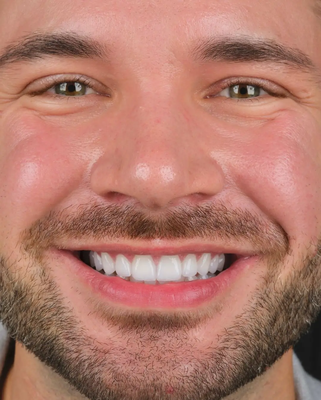 Before and after result, patient photo 2